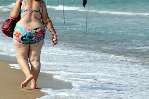 overweight woman with cellulite overweight woman with cellulite