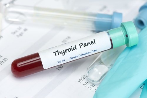 thyroid blood test for hypothyroidism thyroid blood test for hypothyroidism