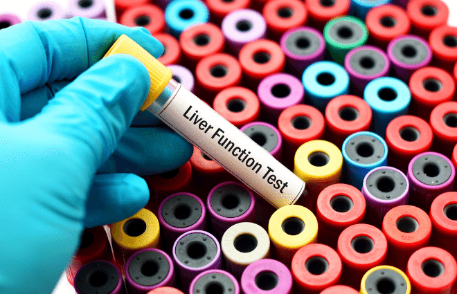 Lab tech with blue gloves holding liver function test vial lifted up from array of blood test tubes.